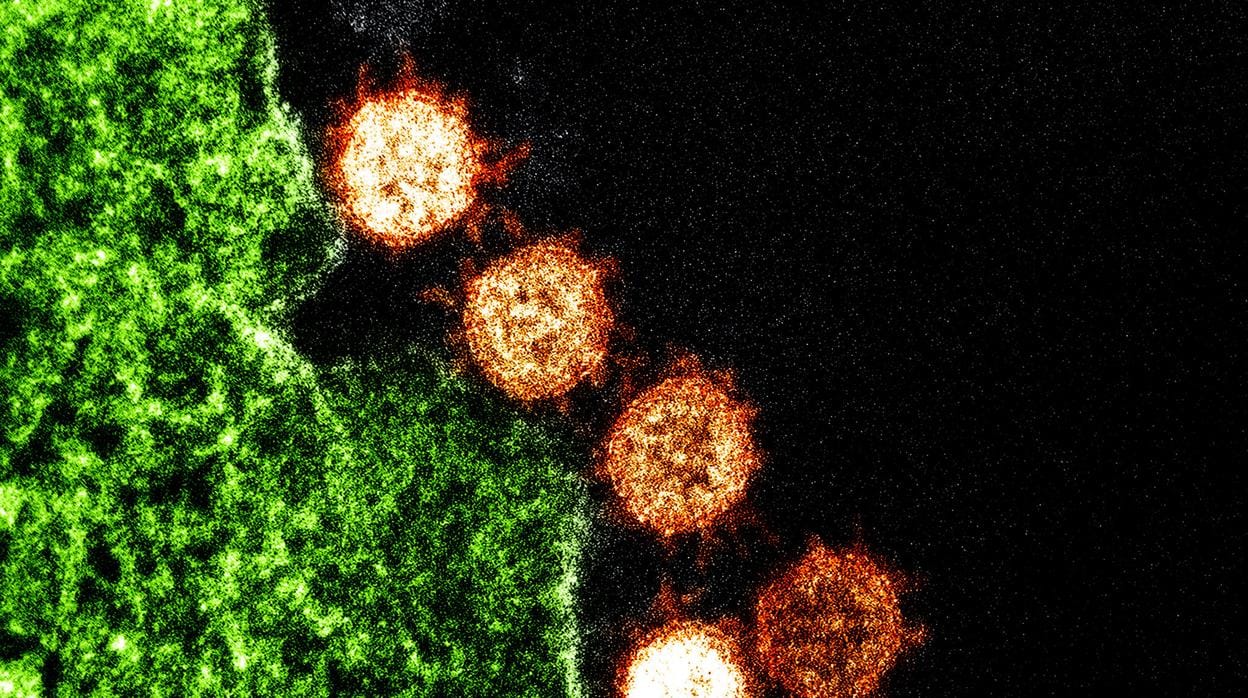 Partículas Virus Sars