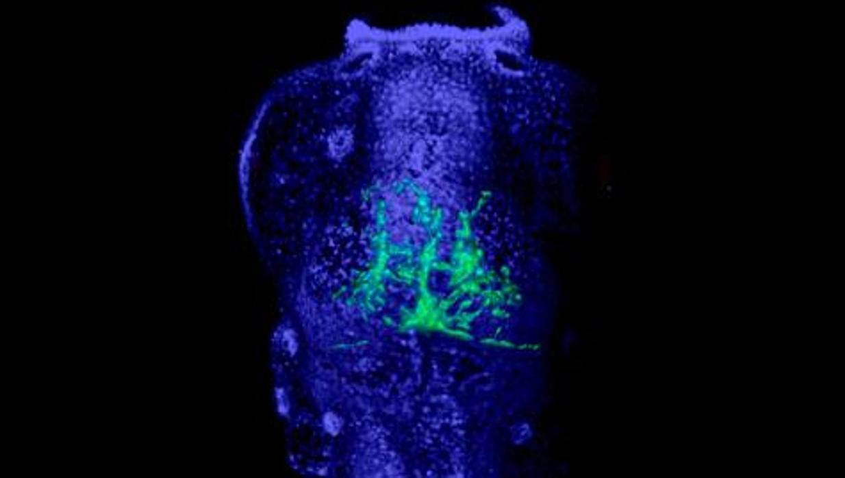 La imagen muestra un embrión de pez cebra con células cancerosas (verde) en su sistema nervioso. Los investigadores utilizaron este tipo de modelo animal para evaluar nuevos tratamientos