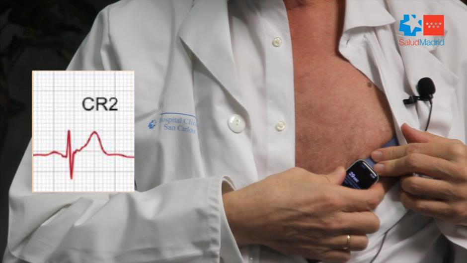 Un médico descubre cómo hacer un electrocardiograma con un «smartwatch»