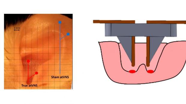 Investigadores españoles consiguen mejorar la memoria en ratones estimulando un nervio de la oreja