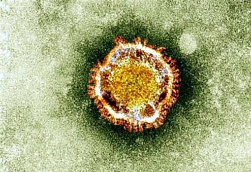 Se llama coronavirus por que el virus tiene puntas en forma de corona en su silueta