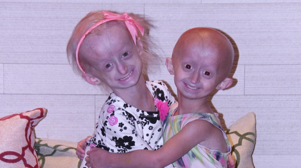 Un modelo en 3D desvela un causante de la progeria