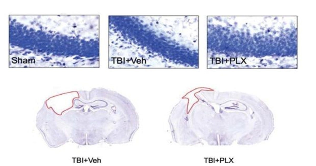 Restablecer la microglía aumenta las neuronas