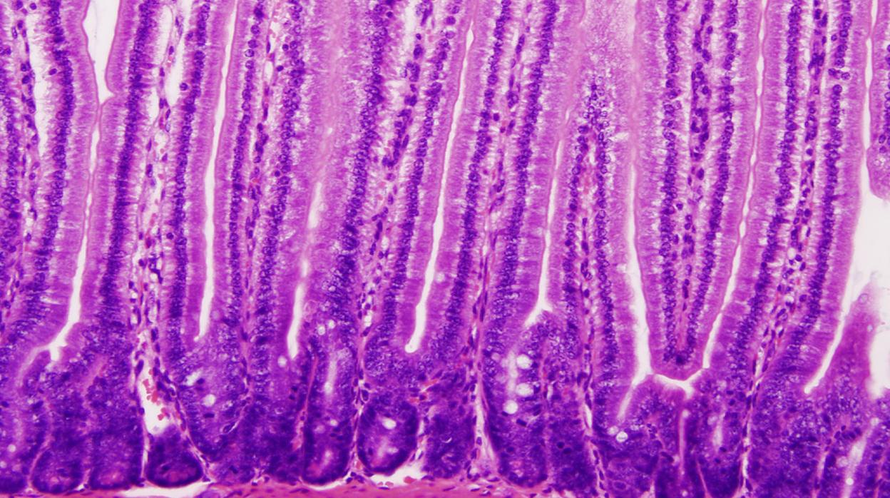 Vellosidades en la mucosa intestinal