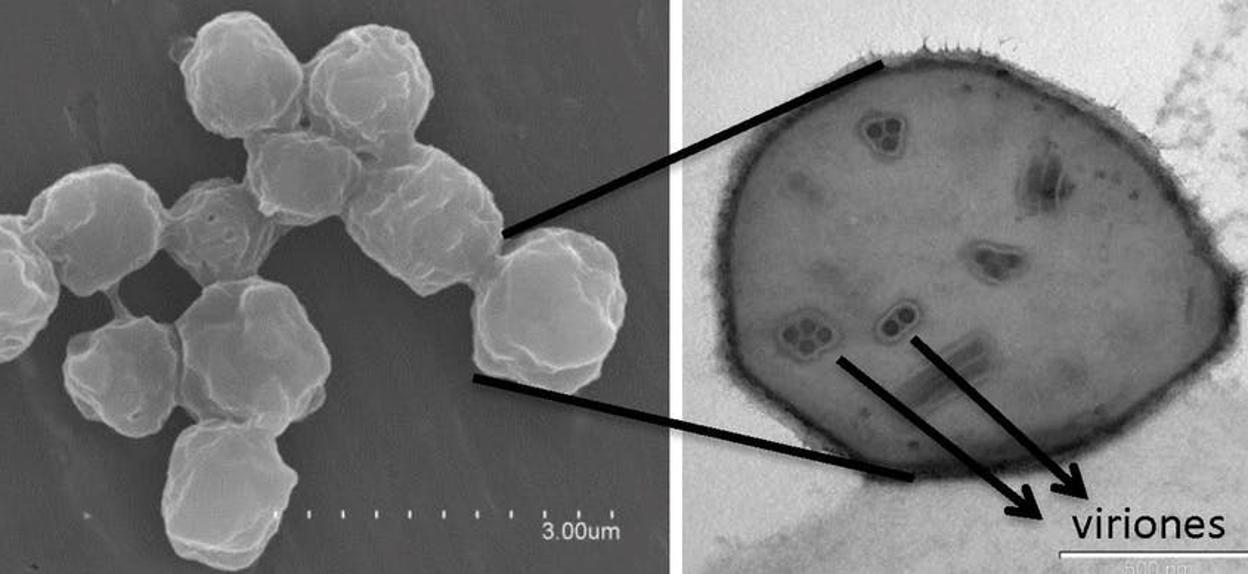 Imágenes de microscopía electrónica de baculovirus