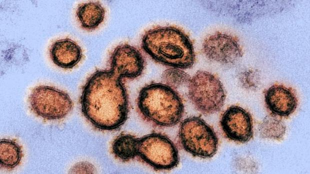 Descubren que un antiparasitario puede matar al coronavirus en 48 horas en pruebas «in vitro»