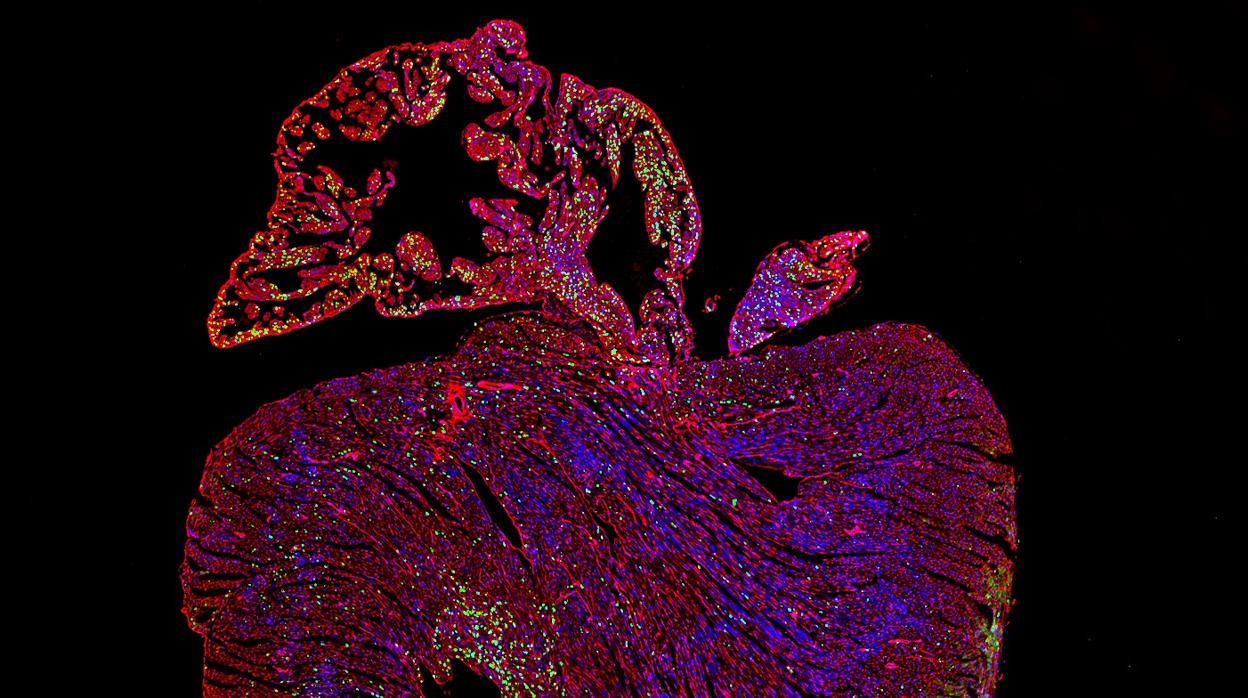 Hacia el primer tratamiento curativo para la enfermedad cardíaca