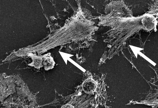 Los neutrófilos detectan las bacterias y pueden expulsar su ADN (ver flechas) para atacar creando sustancias tóxicas que atacan al organismo