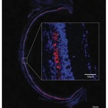 Imagen de microscopía confocal de fluorescencia que muestra la distribución de las nanopartículas (rojo) en el espacio retiniano in vivo (núcleos celulares en azul).