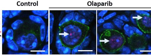 En los huevos primordiales normales de ratón (teñidos de verde), nunca detectamos daños en el ADN. Pero, además de matar los huevos primordiales, el olaparib causa daño en el ADN de algunos huevos que sobreviven, lo que sugiere que morirán pronto o que serán de muy mala calidad para dar a luz a un bebé sano.