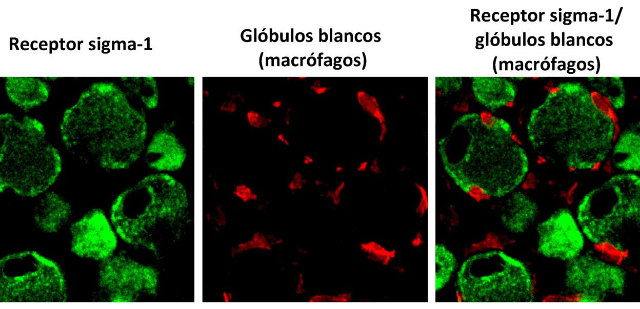 Marcaje inmunohistoquímico de las neuronas sensoriales periféricas que expresan el receptor sigma-1 (en verde), y marcaje de los glóbulos blancos (macrófagos, en rojo), tras la lesión de un nervio en el ratón. Nótese en la fusión de ambas imágenes que los macrófagos se acumulan abrazando a las neuronas sensoriales.