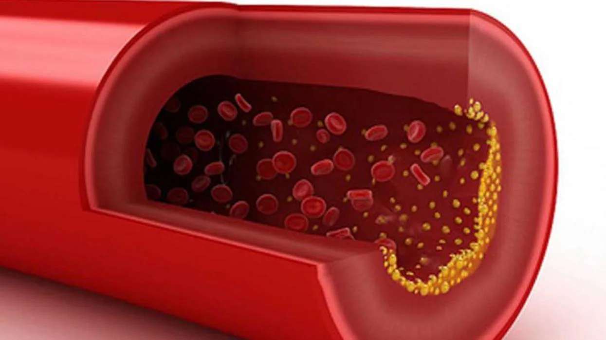 Las concentraciones de colesterol excesivamente elevadas –o demasiado bajas– puede desencadenar problemas en la salud