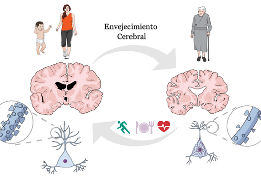 Envejecimiento cerebral.