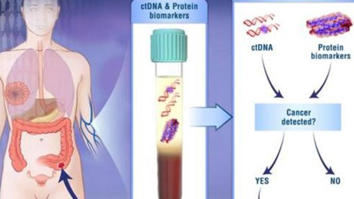 Biopsia líquida