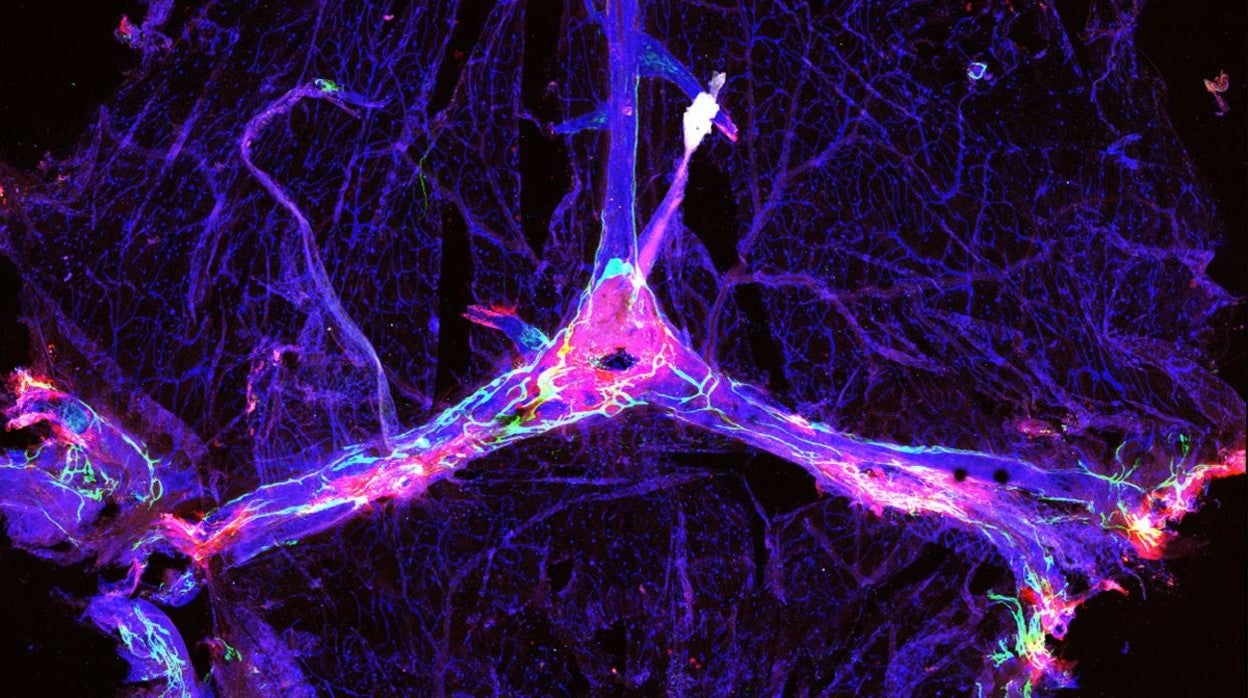 Sistema linfático meníngeo