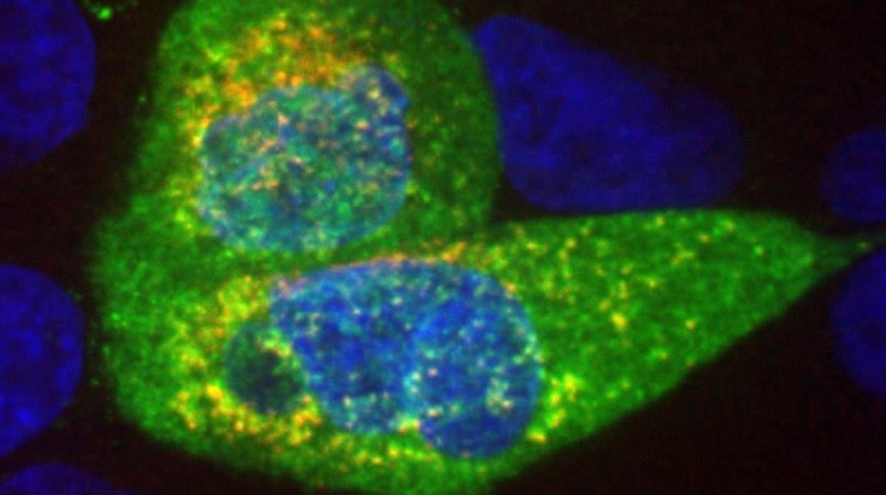 Imagen de células de cáncer de pulmón infectadas con el virus SARS-CoV-2. El azul representa el ADN, el verde muestra la proteína de la nucleocápside del SARS-CoV-2 y el rojo representa el ARN de doble cadena, que se produce cuando el virus replica su genoma