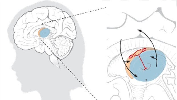 Este anticuerpo previene los efectos a largo plazo de una lesión cerebral traumática