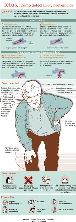 Ictus: ¿Cómo detectarlo y prevenirlo?