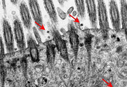 Micrografía electrónica de los tejidos de los bronquios humanos después de la infección por SARS-CoV-2. Flechas rojas que muestran partículas virales.