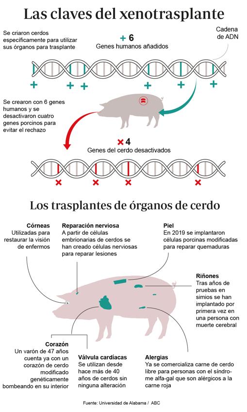 Trasplantan por vez primera dos riñones de cerdo a una persona