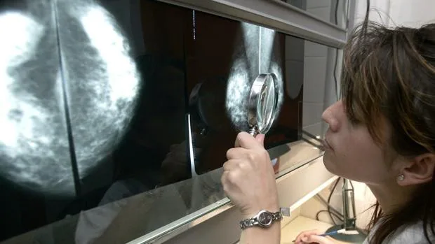 Las mamografías también detectan el riesgo cardiovascular