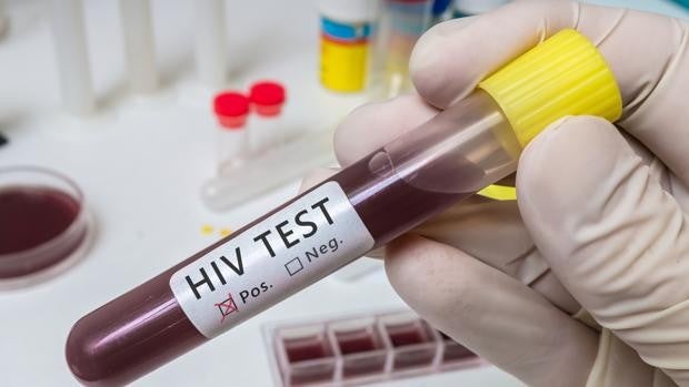 Estas son las personas en las que se podría erradicar el VIH