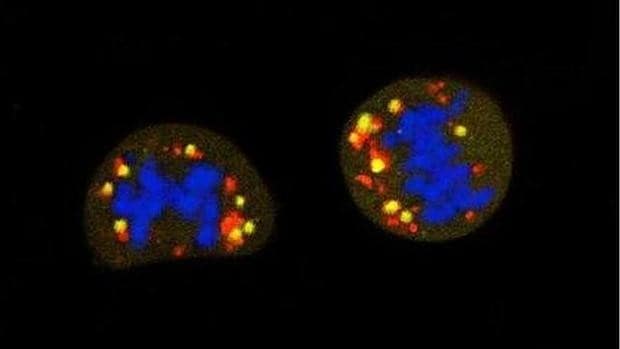 Identifican las causas genéticas de tres enfermedades mitocondriales