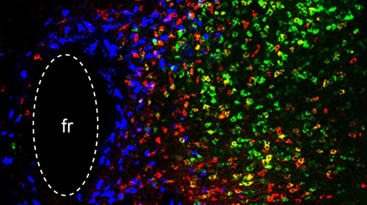 Imagen del tálamo parafascicular (PF), las células azules participan en el procesamiento de recompensas/depresión, las células rojas son fundamentales para el aprendizaje motor y las células verdes son importantes para la locomoción general. El 'fr' representa un haz de fibras