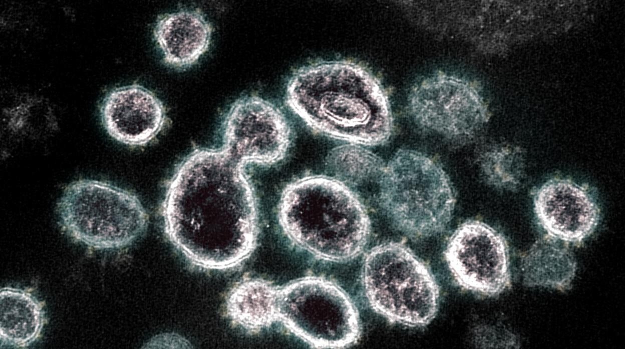 Imagen microescópica del Virus SARS-COV-2