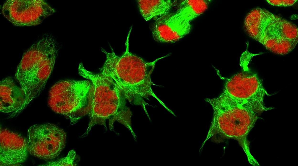 Células de neuroblasma vistas desde un microscopio