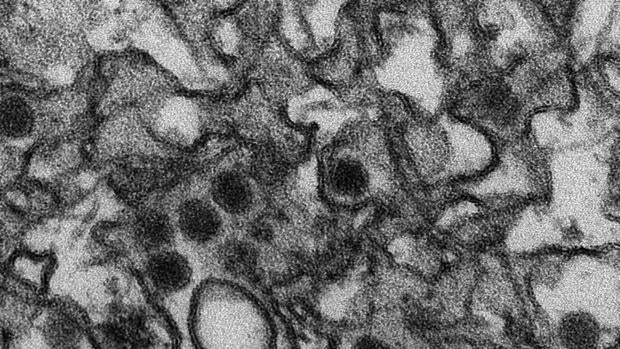 Imagen del virus zika en el microscopio