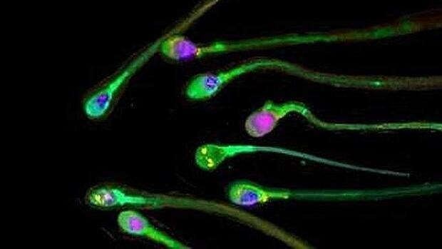 Científicos chinos han diseñado un método fiable que permite fabricar células espermáticas en una placa de cultivo