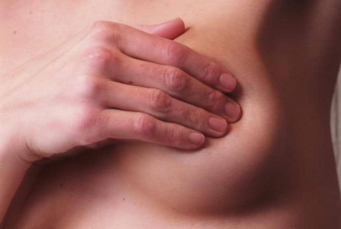 Todo lo que tienes que saber sobre el cáncer de mama