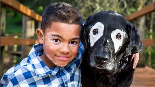 La increíble historia del niño de 8 años que superó el rechazo a su rostro tras conocer a un perro con su misma enfermedad