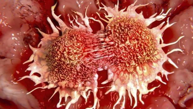 Oncólogos fijan 2025 como el año en que empezarán a bajar los casos de cáncer