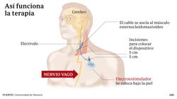 Las 6 noticias que debes saber hoy, martes 26 de septiembre