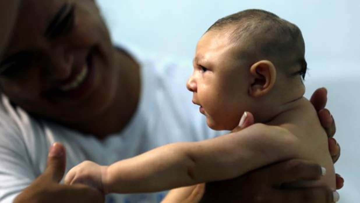 Un niño afectado en Recifre, Brasil, de microcefalia porque su madre contrajo el virus del zika
