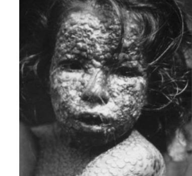 La historia más triste de Benjamin Franklin y la viruela