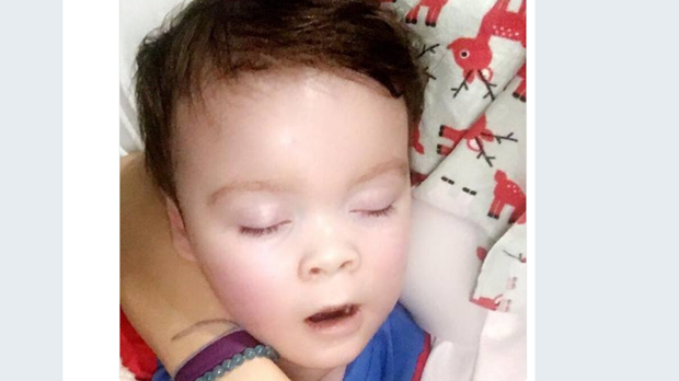 Italia tiene preparado avión medicalizado para trasladar al bebé Alfie Evans