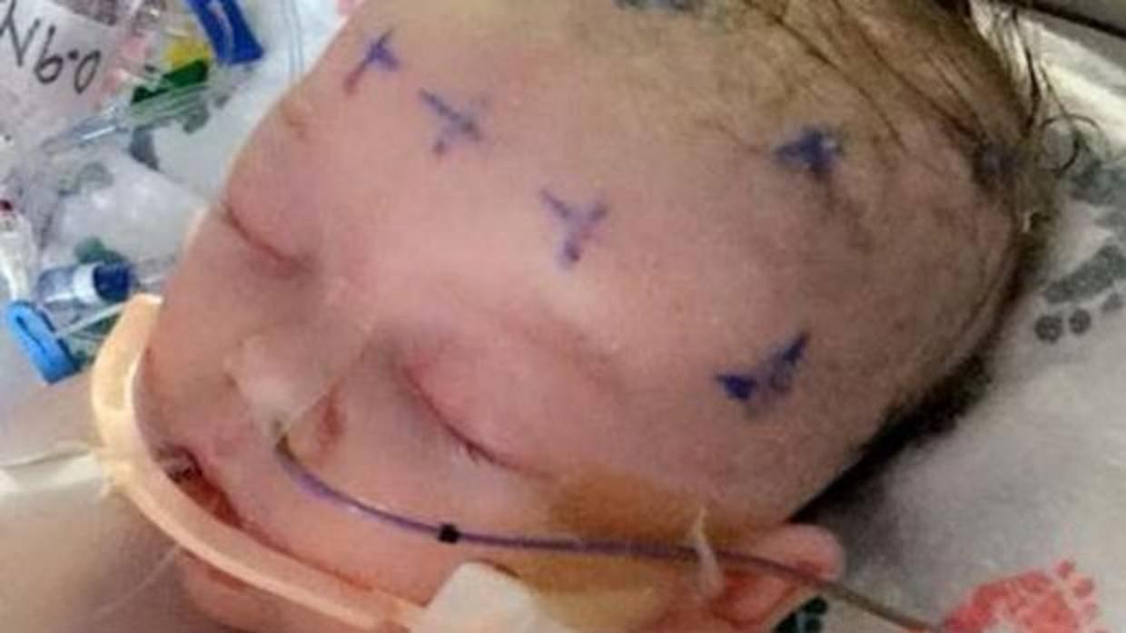 Una niña de 7 meses de Iowa lucha por su vida tras ser golpeada por una pelota de sóftbol