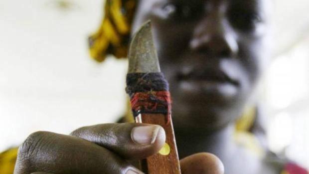 Unas 60 niñas, hospitalizadas tras sufrir mutilación genital en Burkina Faso