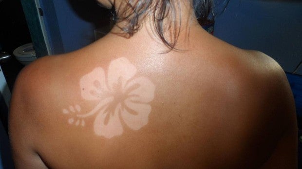 La peligrosa moda de los tatuajes solares que enloquece a los británicos