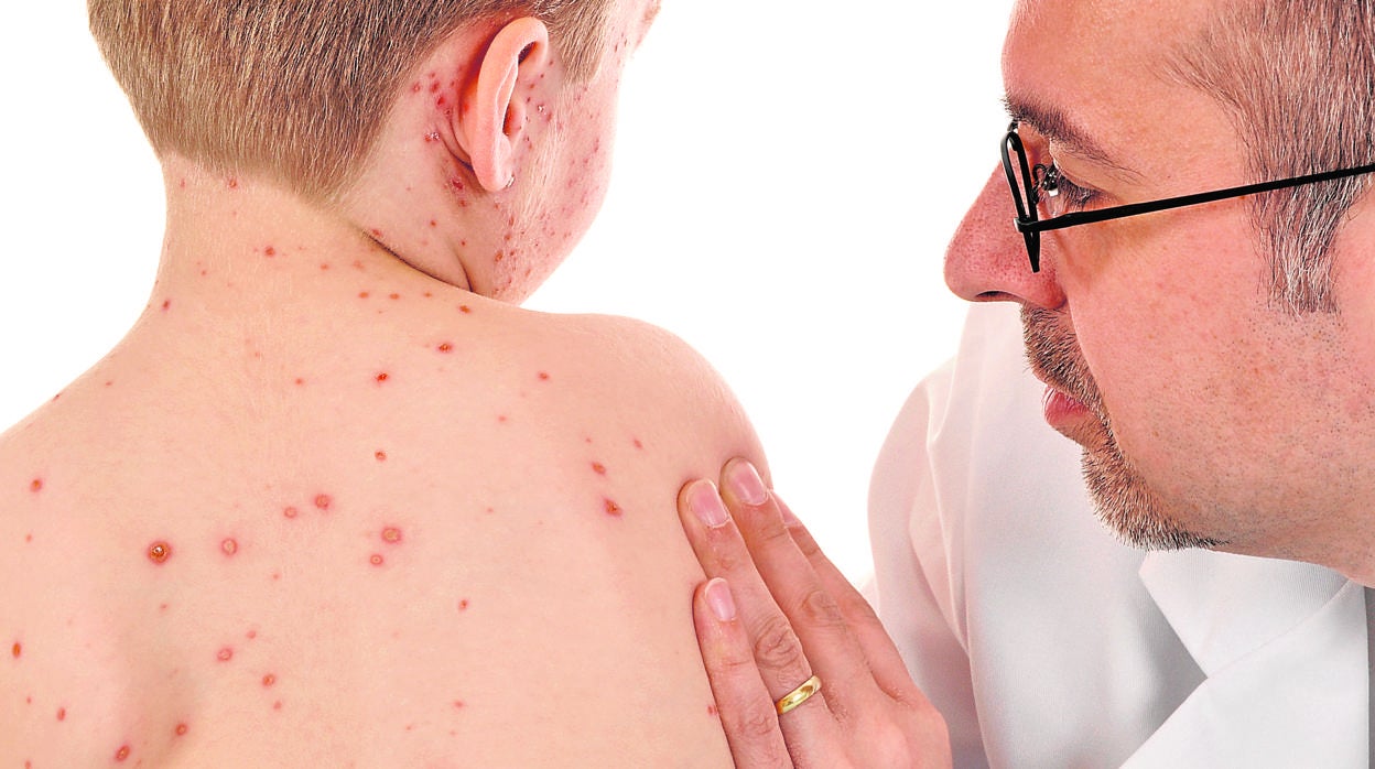 Médico mirando a un niño con sarampión