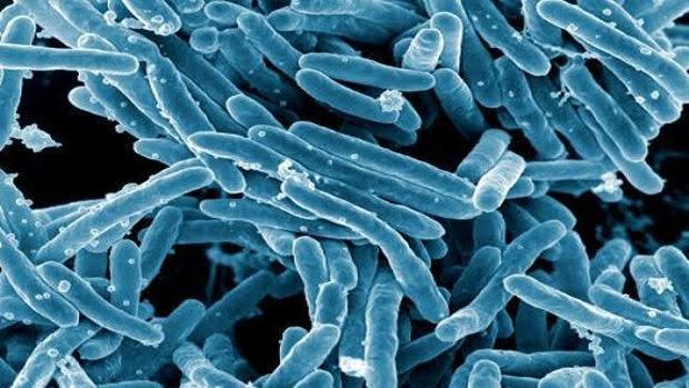 La OMS destaca el «récord» en 2018 en administrar el tratamiento contra la tuberculosis en todo el mundo