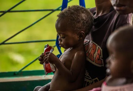 Sensación de «impotencia» en Unicef ante los más de ocho millones de niños desnutridos en República Democrática del Congo