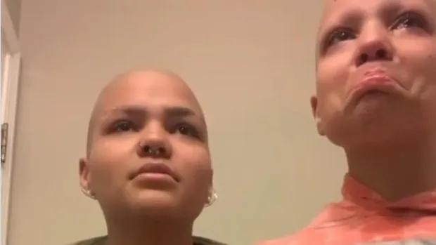 La hermana de una menor enferma de cáncer se rapa el pelo en solidaridad con ella: «Estoy contigo en esto»