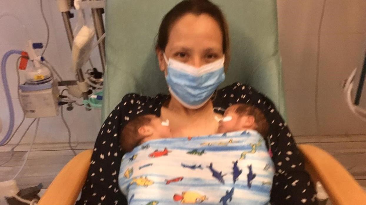 Una enferma grave de Covid-19 da a luz a gemelas prematuras y al despertar no recuerda su embarazo