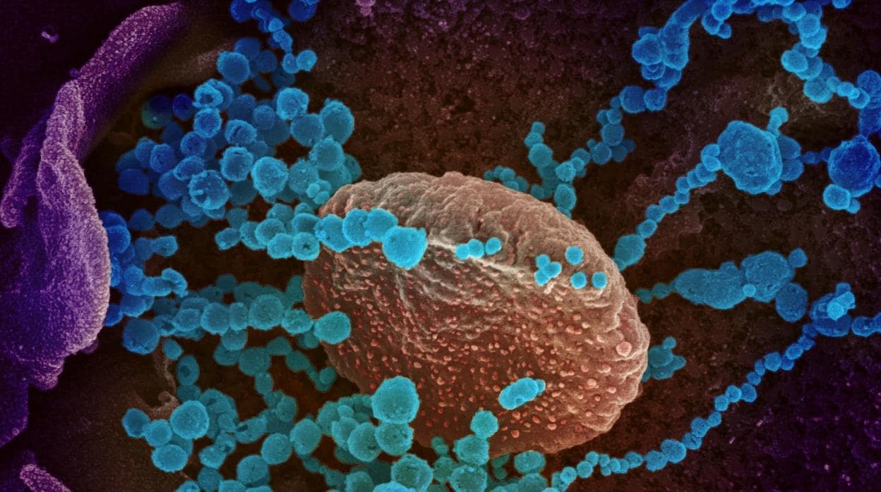 Muestra de coronavirus (objetos azules redondos) vista con un microscopio electrónico