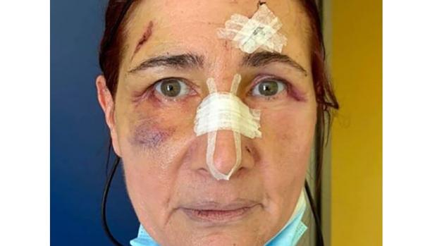 Una mujer italiana es apaleada por regañar a un hombre de Mali que no llevaba mascarilla