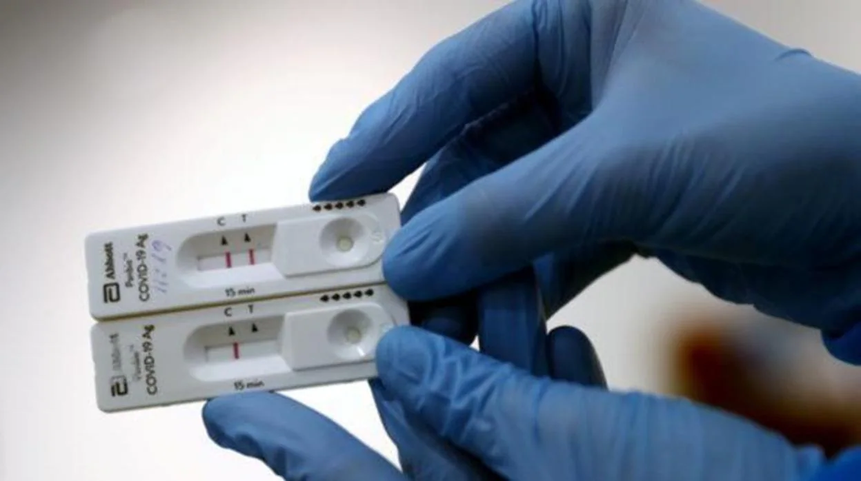 El test ELISA es una prueba serológica que sirve para detectar la presencia de anticuerpos contra el coronavirus en la sangre de un paciente
